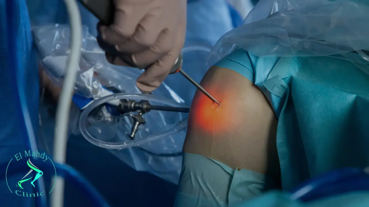 كم تستغرق عملية منظار الركبة