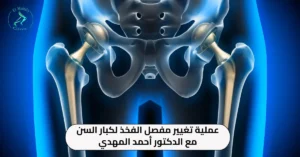 عملية تغيير مفصل الفخذ لكبار السن