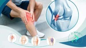اعراض تمزق الرباط الجانبي في الركبة